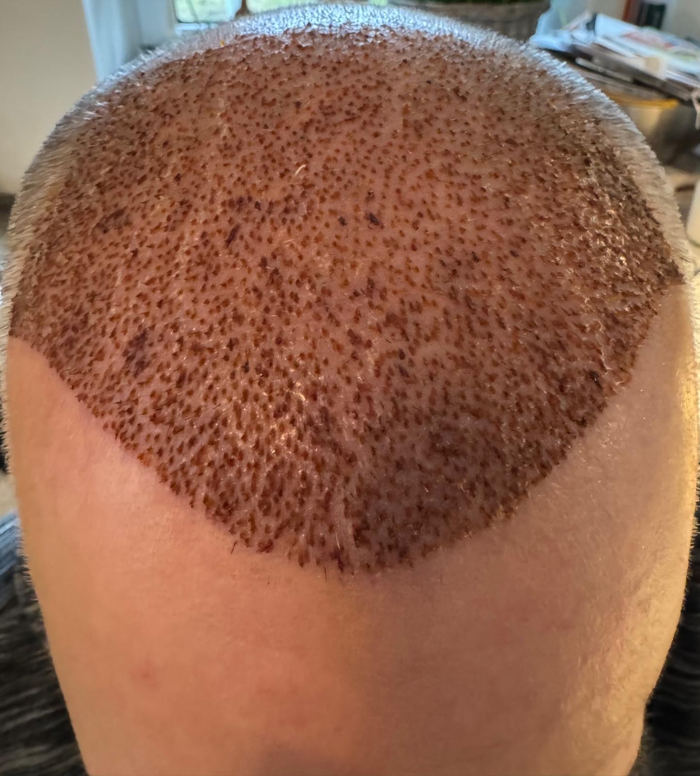 /foren/transplant/index.php/fa/67305/0/[img]/foren/transplant/index.php/fa/67306/0/[/img]